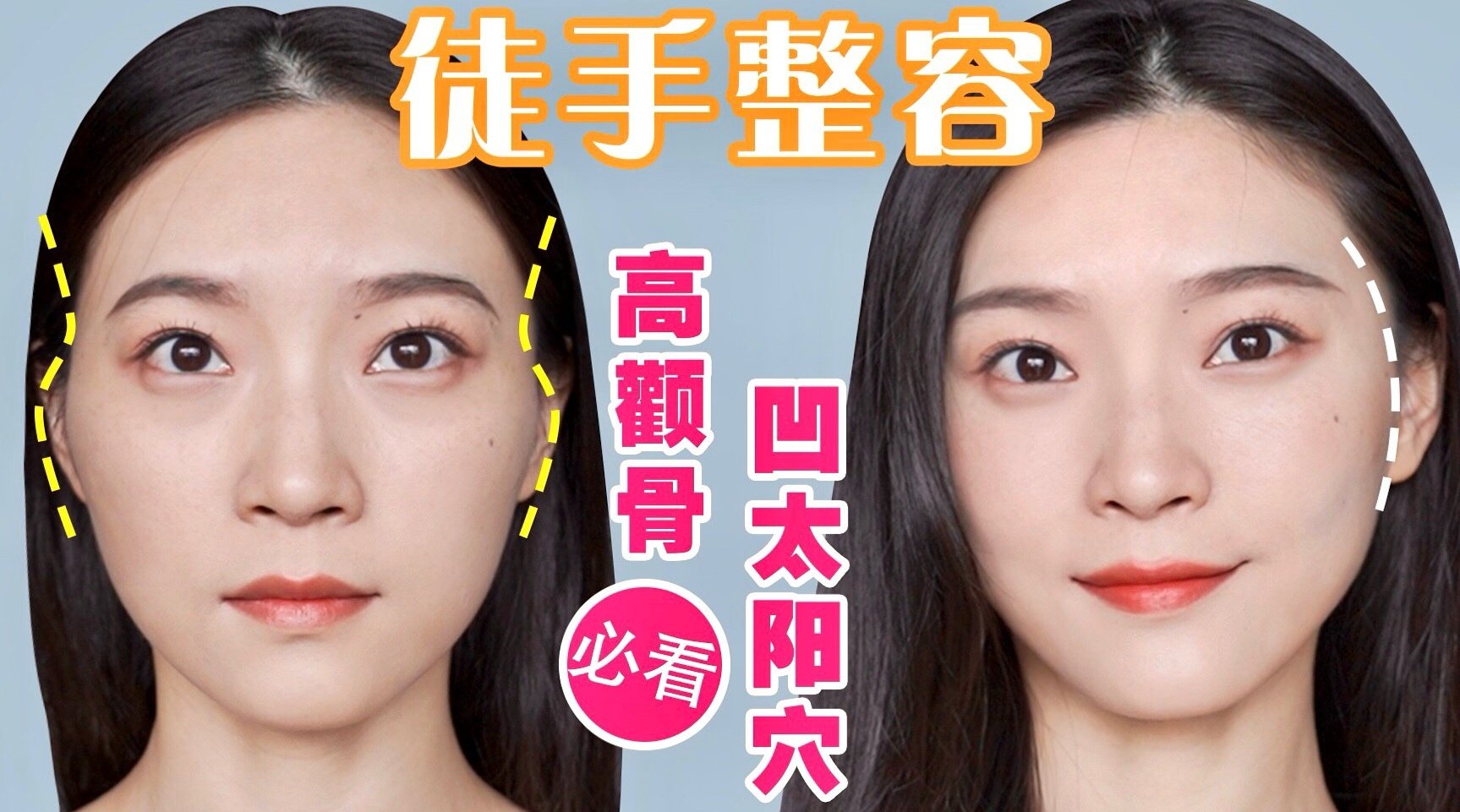 颧骨外扩? 太阳穴凹陷